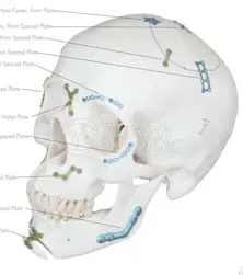 Cirugía cráneo-maxilofacial