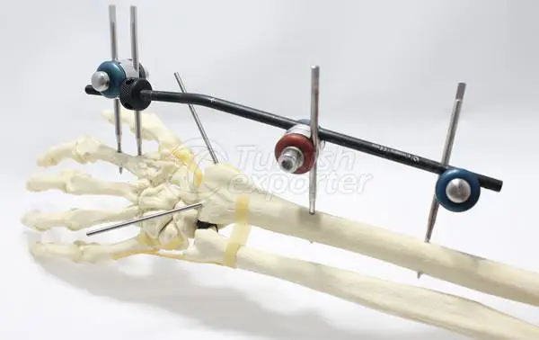 Small Tubular Fixator System